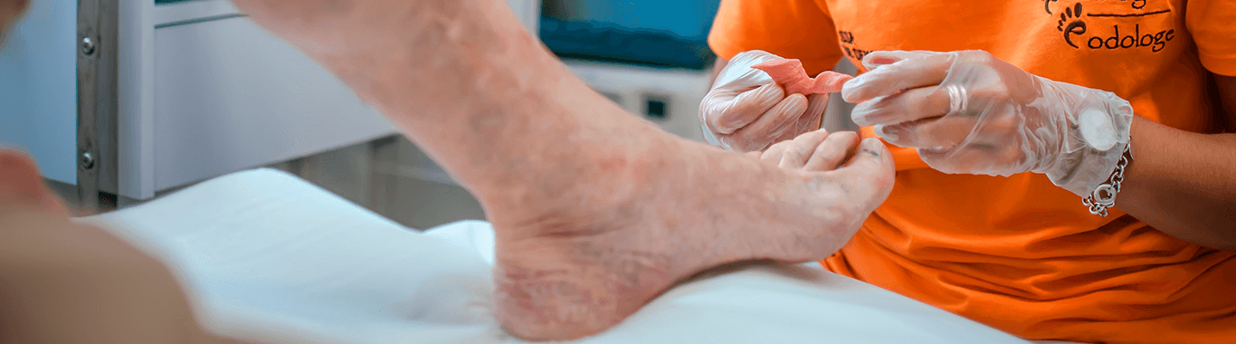 Atendimento Podológico ao Paciente com Diabetes